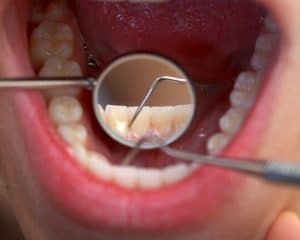 dental care Albuquerque New Mexico | Oral Care NM | Steven E. Holbrook D.M.D