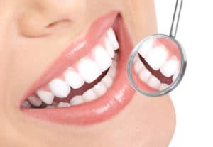 Dental Cleanings Albuquerque, NM