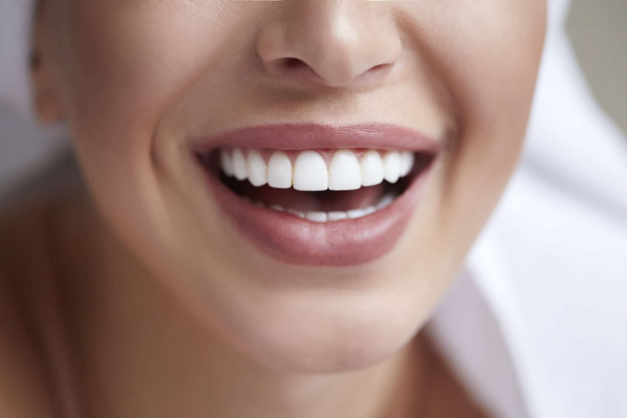 A woman is smiling and showing off her beautiful cosmetic dental work