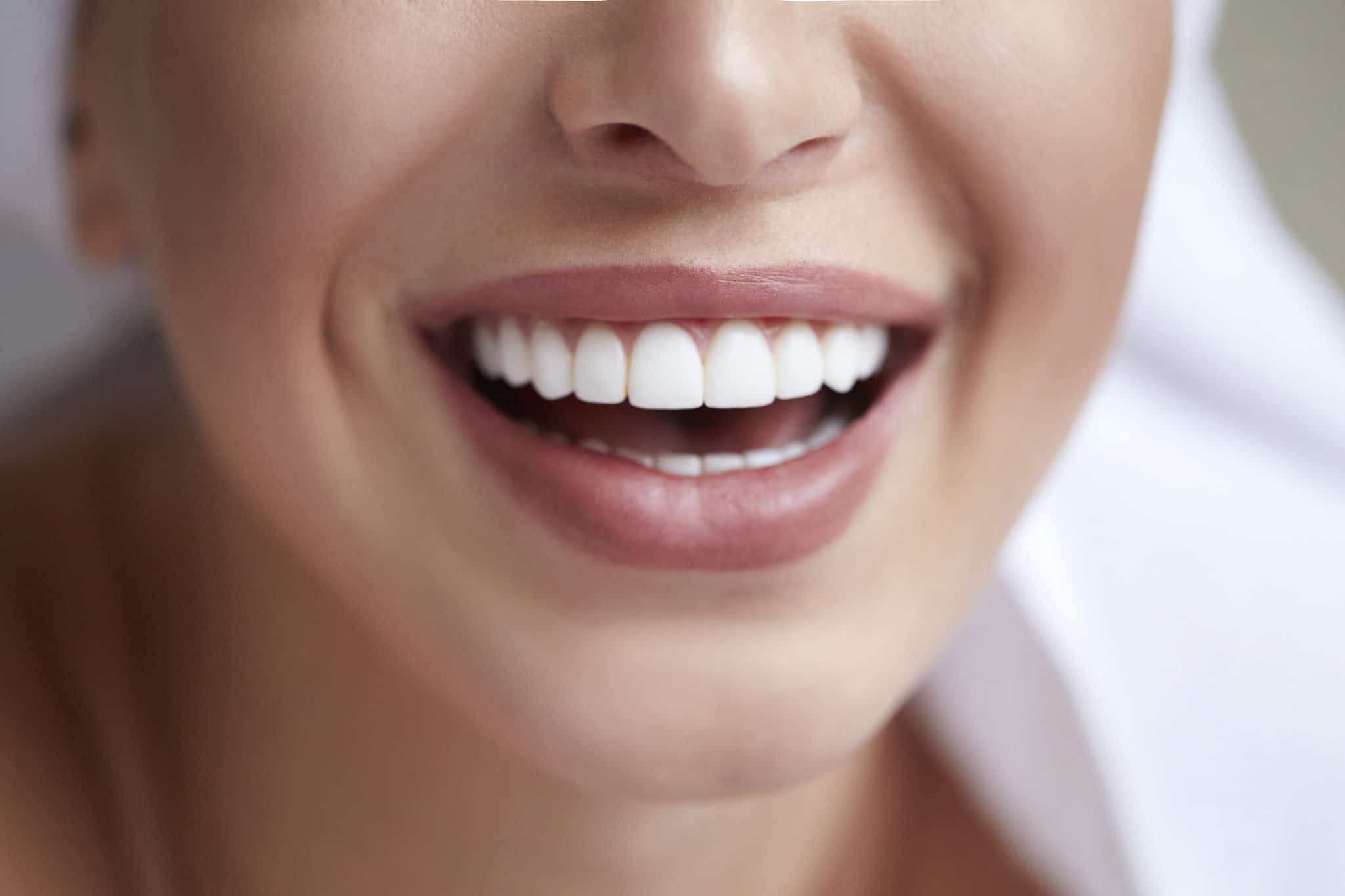 porcelain veneers in albuquerque new mexico