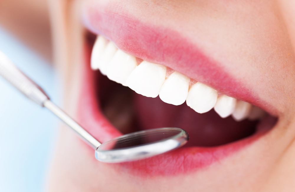 A close-up shot of a woman with porcelain crowns getting a dental exam