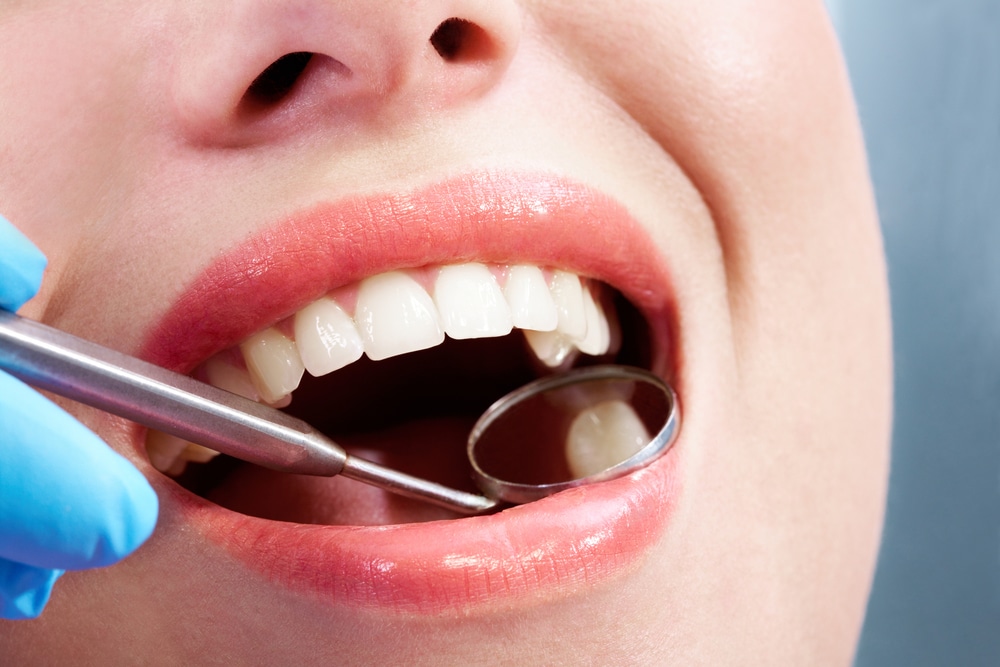 Oral checkup shows a cavity has been filled with composite resin.