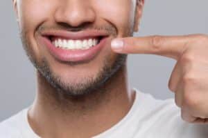 Latino man points to his white teeth, happy with the brighter smile.